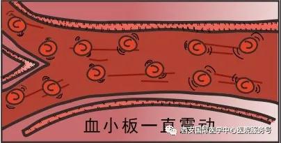血小板是正常值的三倍？專家提醒小心血栓和出血！