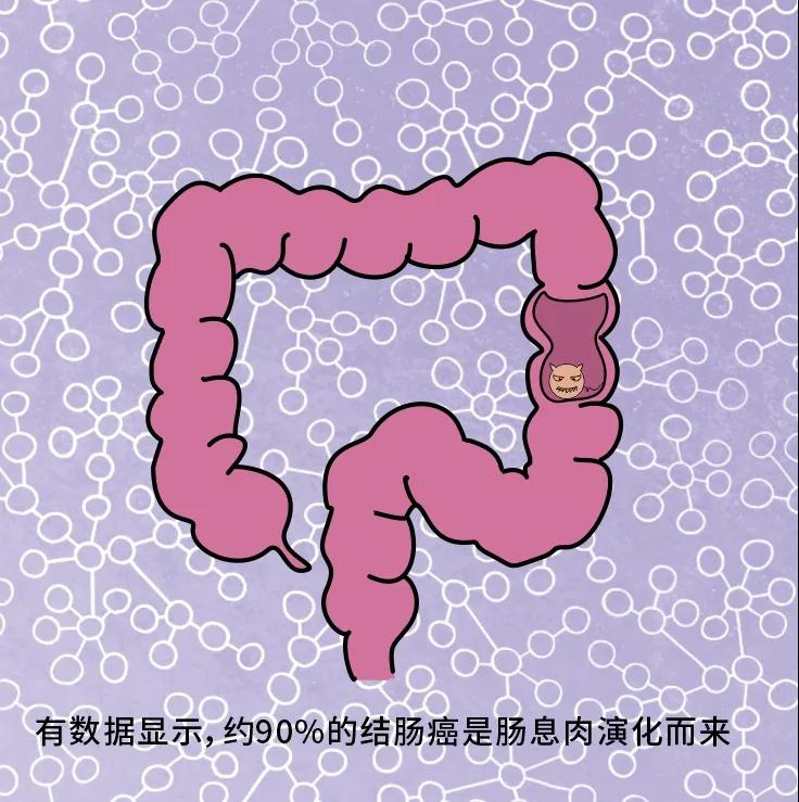 奪走“黑豹”生命的結(jié)腸癌，到底什么來頭？