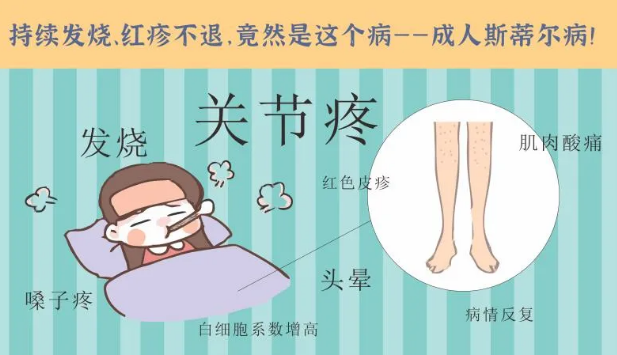 持續(xù)發(fā)燒、紅疹不退……她終于在這里治好了這個罕見病