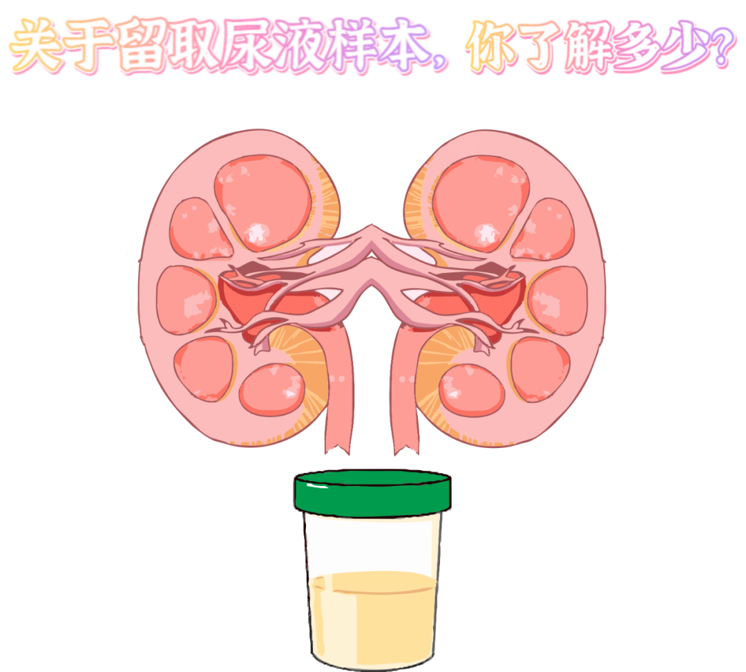 做尿檢，不得不說(shuō)的注意事項(xiàng)！