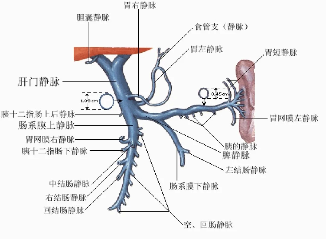 反復(fù)嘔血、黑便怎么辦？TIPS手術(shù)能解決