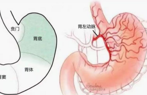不開刀不吃藥不餓肚子，微創(chuàng)介入減肥靠譜嗎？