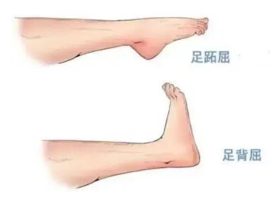 扭胯小連步、動感搖花手……“科目三”雖火，運動損傷也要防！